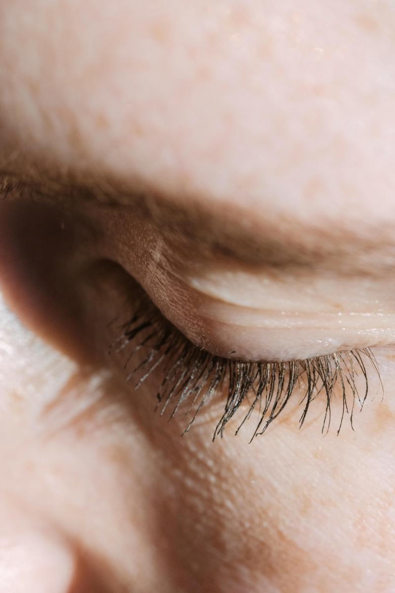 Eyelid closeup