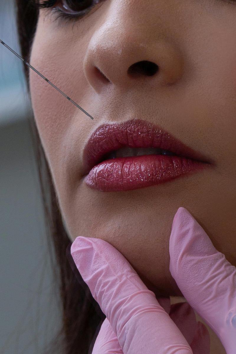 Lip filler