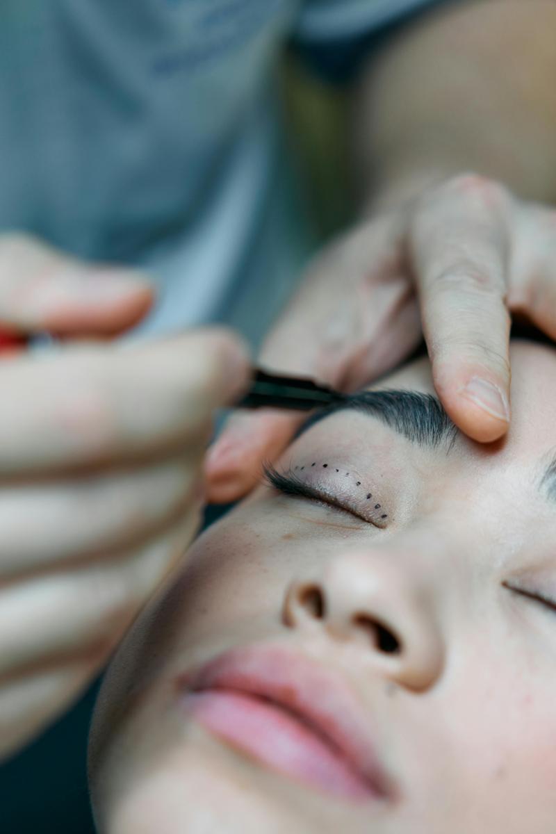 eyelid surgery